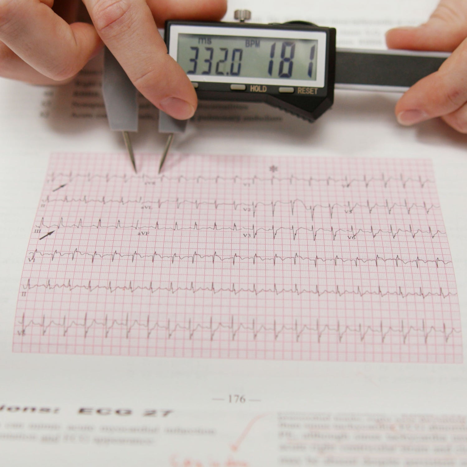 ARKA digital caliper measuring an EKG